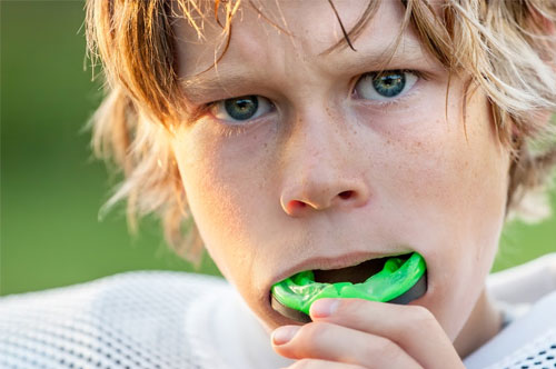 Get Ready to Win With a Custom Athletic Mouthguard